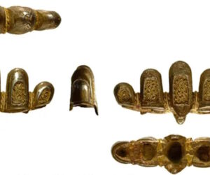 Meta Detector Hobbyist Found Gold Pommel